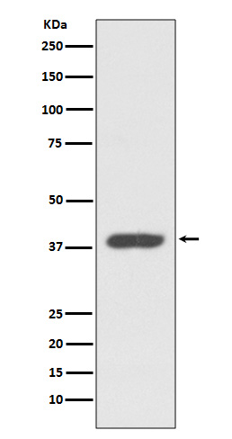 CXCR7 Ab