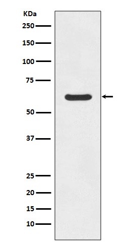 Asparagine synthetase Ab