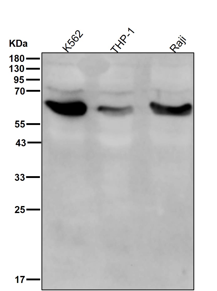 Asparagine synthetase Ab