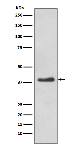 DKK1 Ab