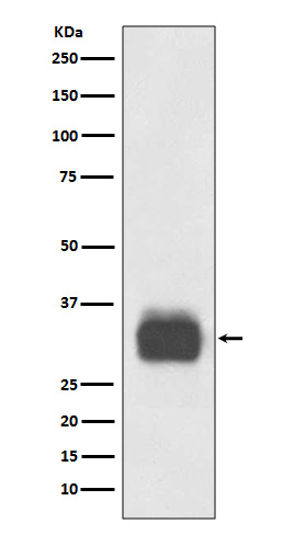 Tryptase 1 Ab