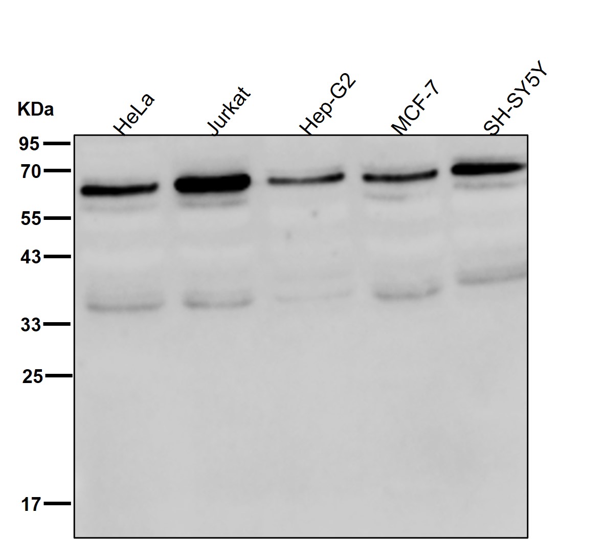 TCF7L2 Ab