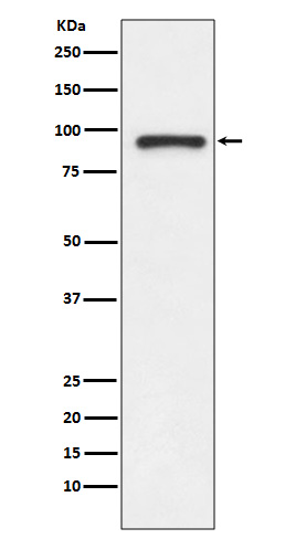 Topoisomerase 1 Ab