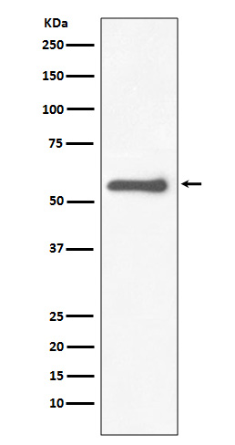 Tyrosine hydroxylase Ab