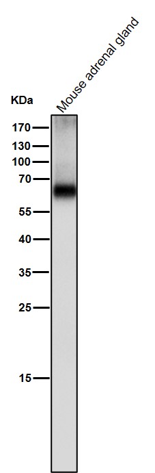 Tyrosine hydroxylase Ab