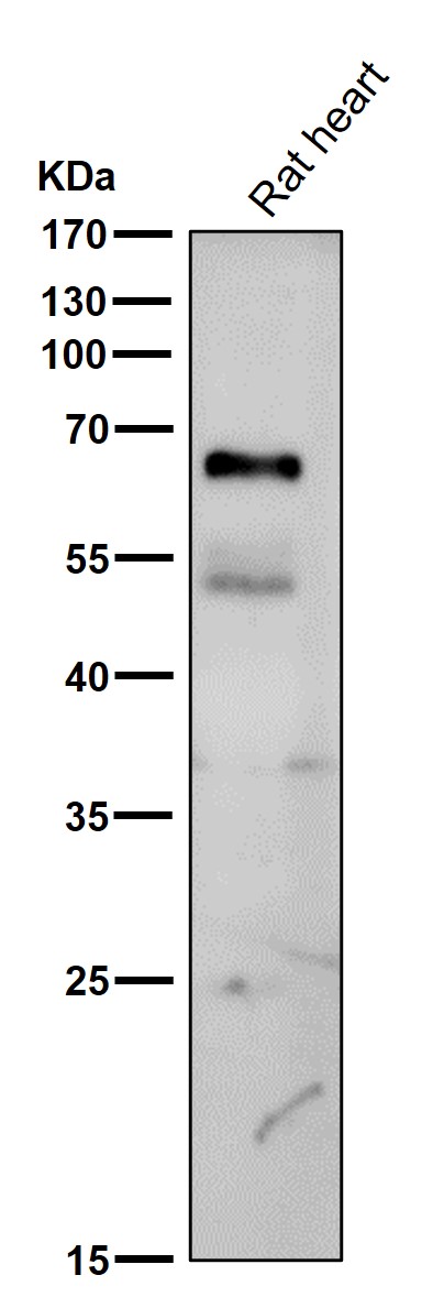 Tyrosine hydroxylase Ab