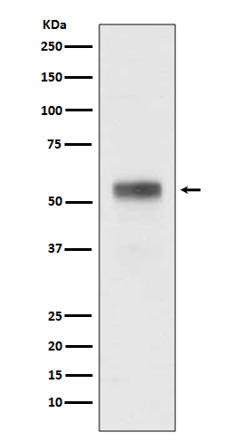 Retinoic acid receptor alpha Ab