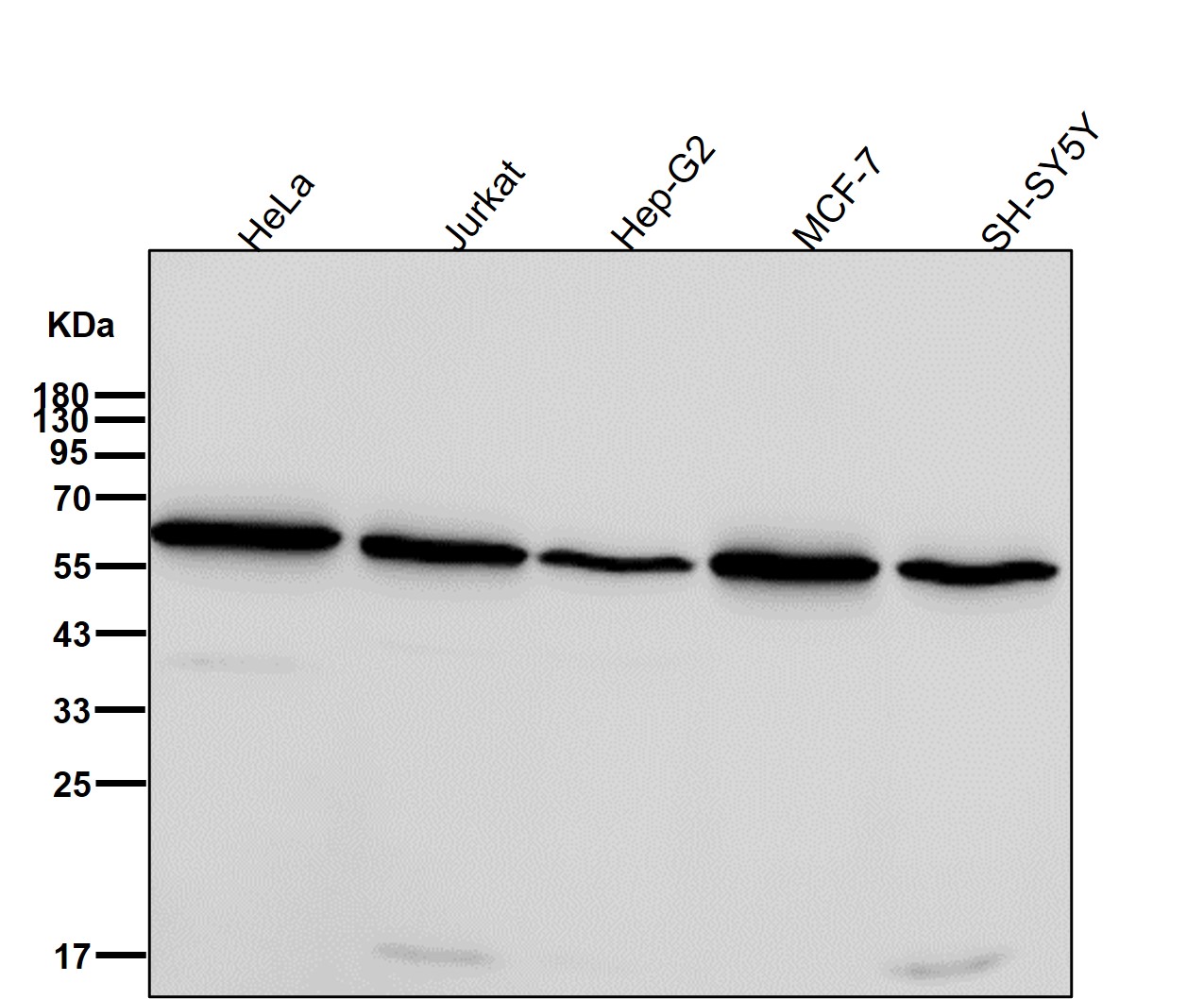 Retinoic acid receptor alpha Ab