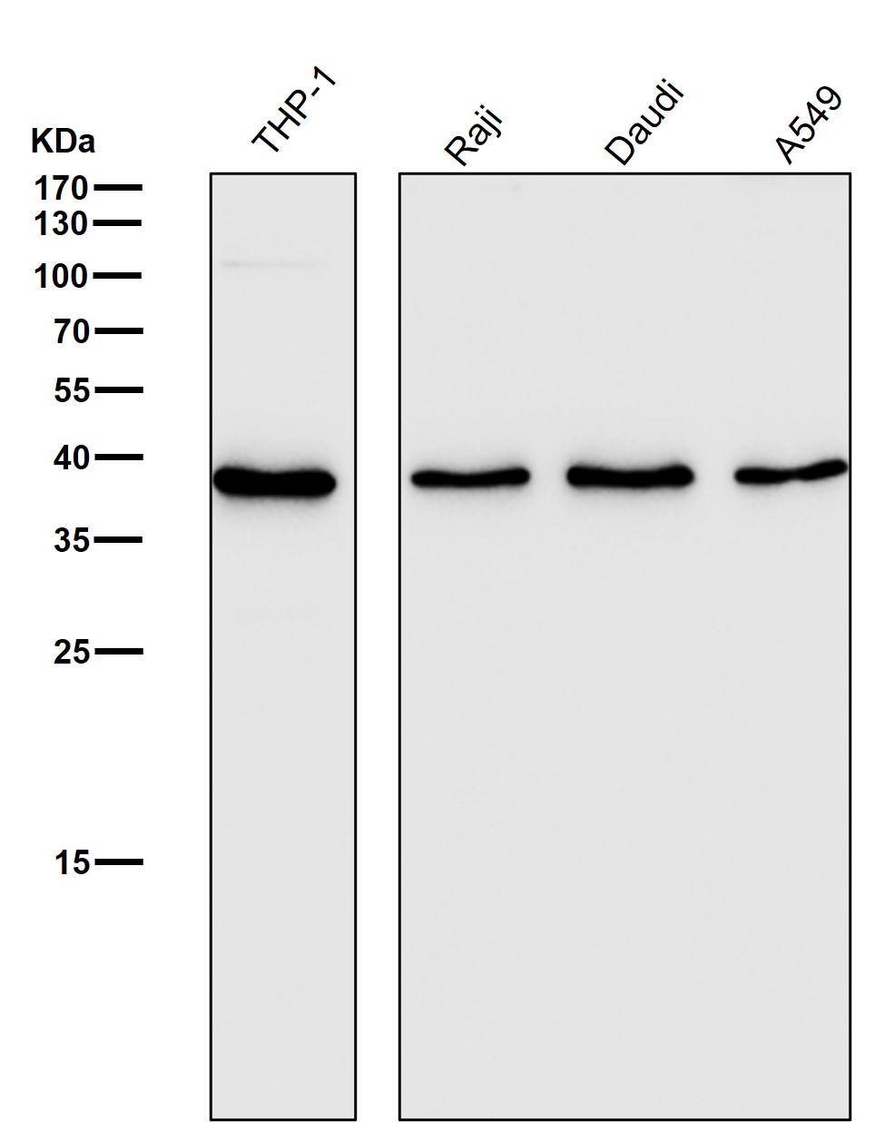 CD68 Ab