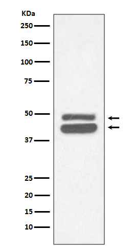 Cytokeratin 18 Ab