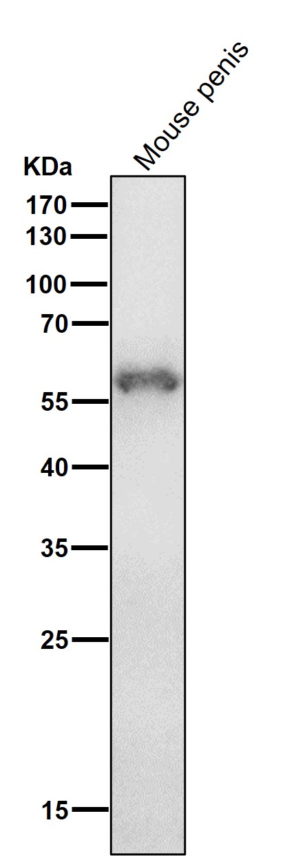 Cytokeratin 4 Ab