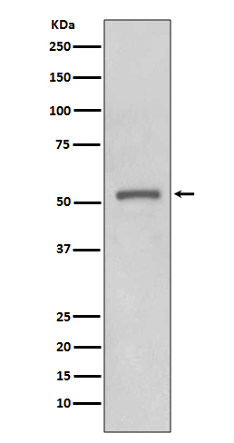 MMP11 Ab