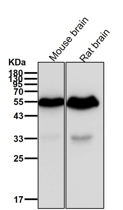 MMP11 Ab