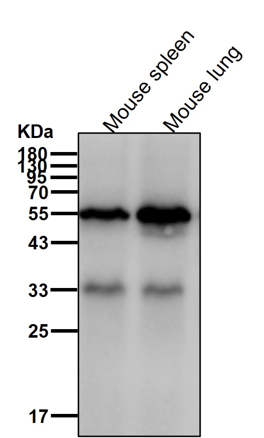 MMP11 Ab