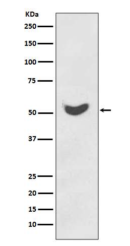 Cytokeratin 7 Ab