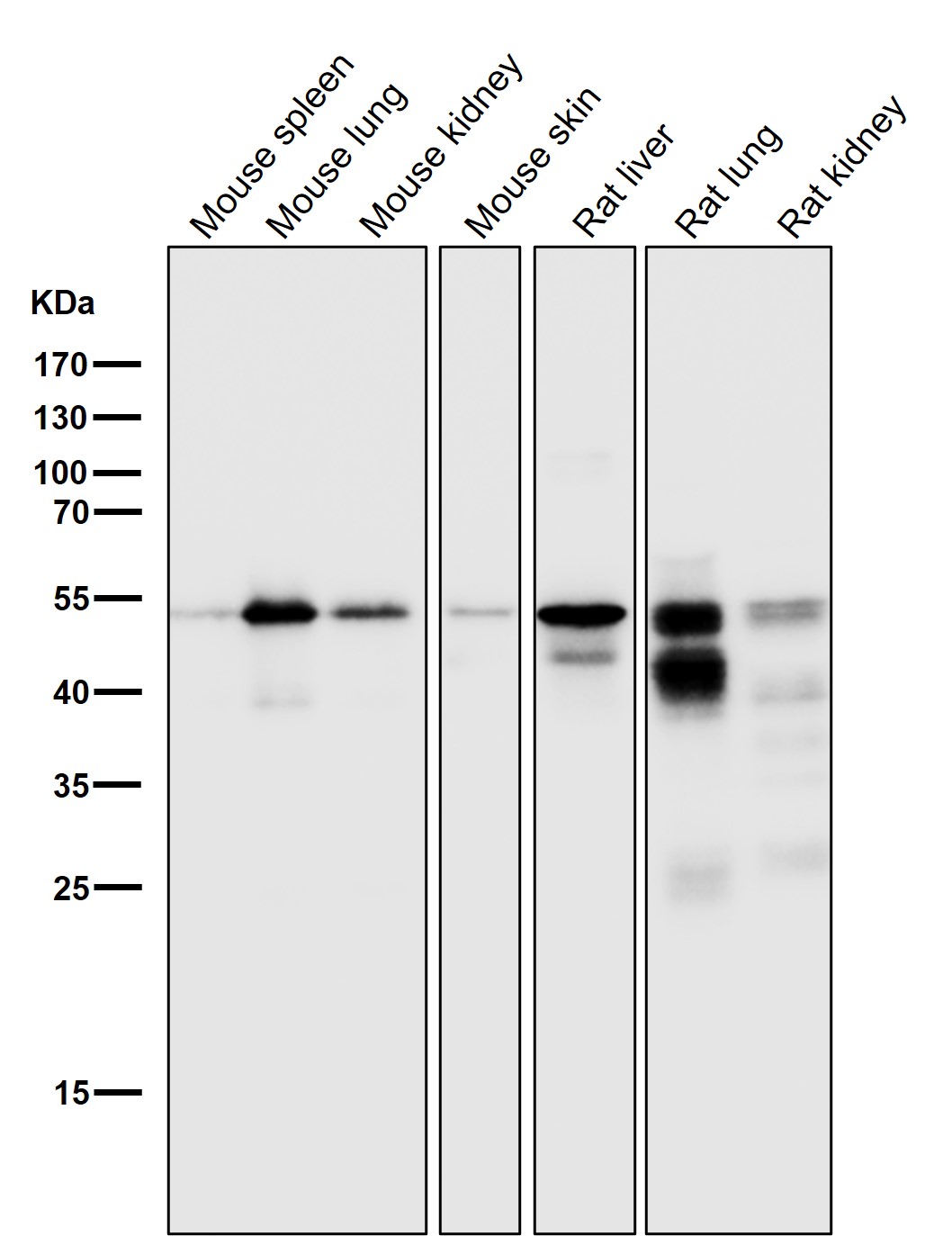 Cytokeratin 7 Ab