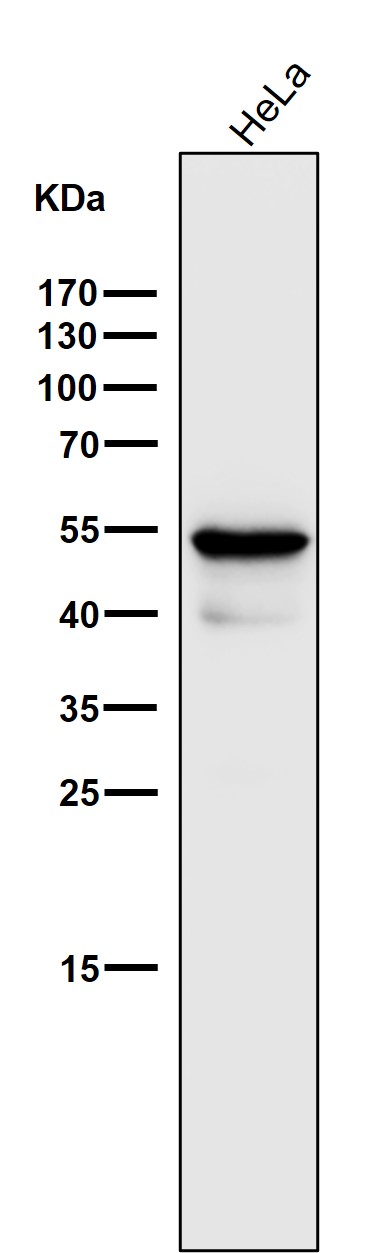 Cytokeratin 7 Ab