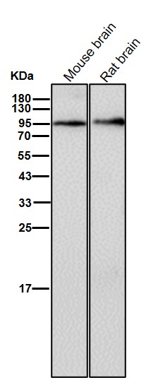 Glycogen synthase Ab