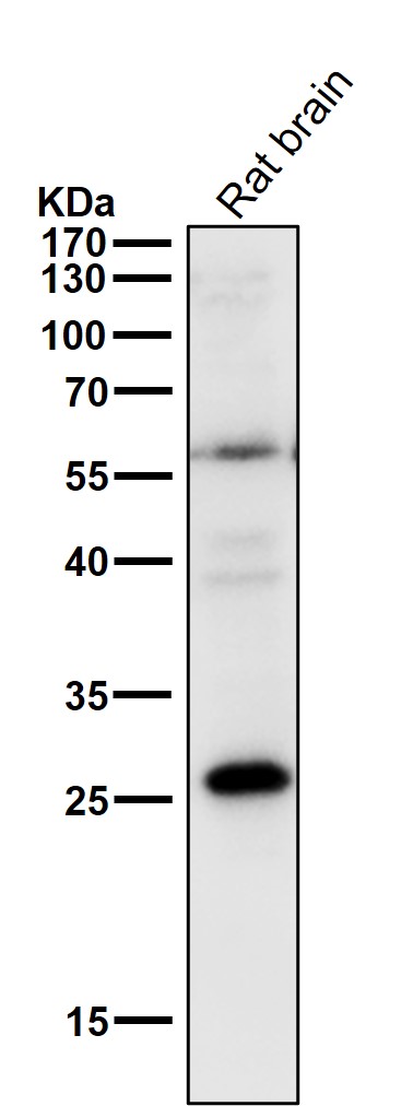 PPP1R1A Ab