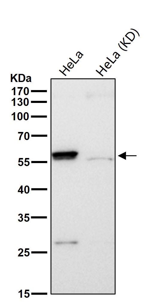 Cytokeratin 4 Ab