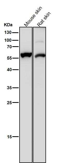 Cytokeratin 4 Ab