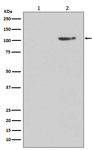 p-GluR1 (S845) Ab