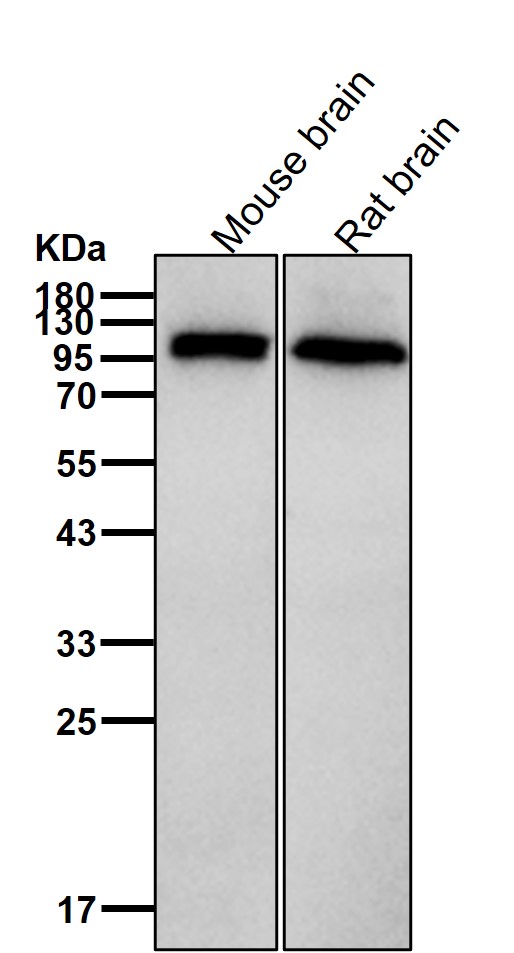 p-GluR1 (S845) Ab