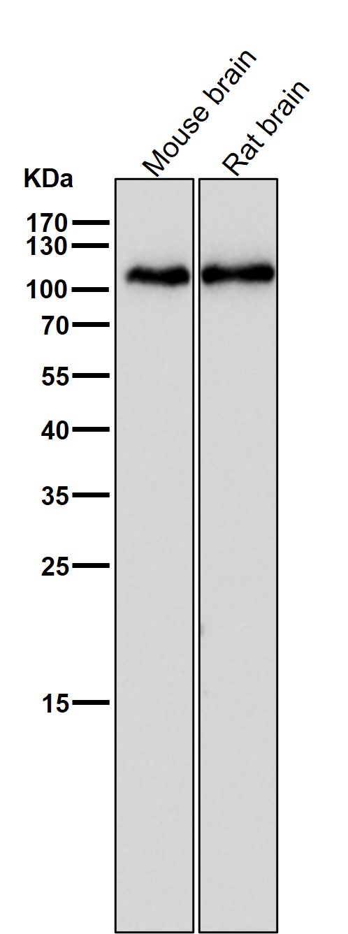 GluR1 Ab