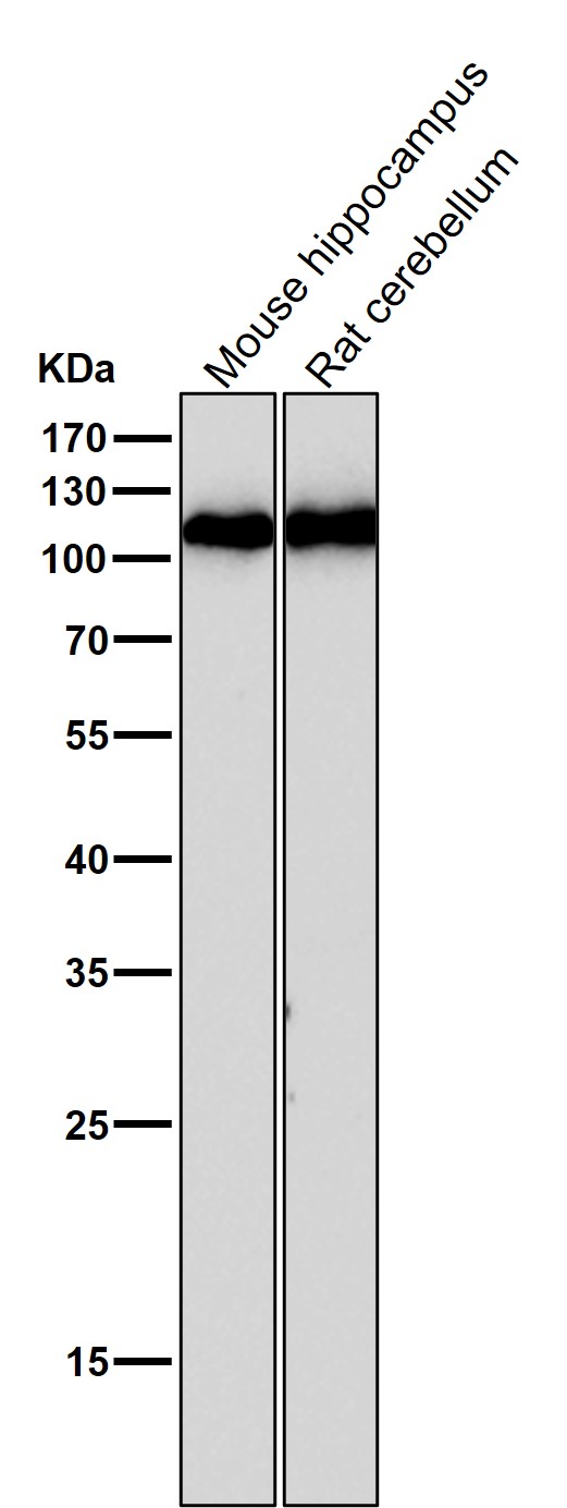 GluR1 Ab