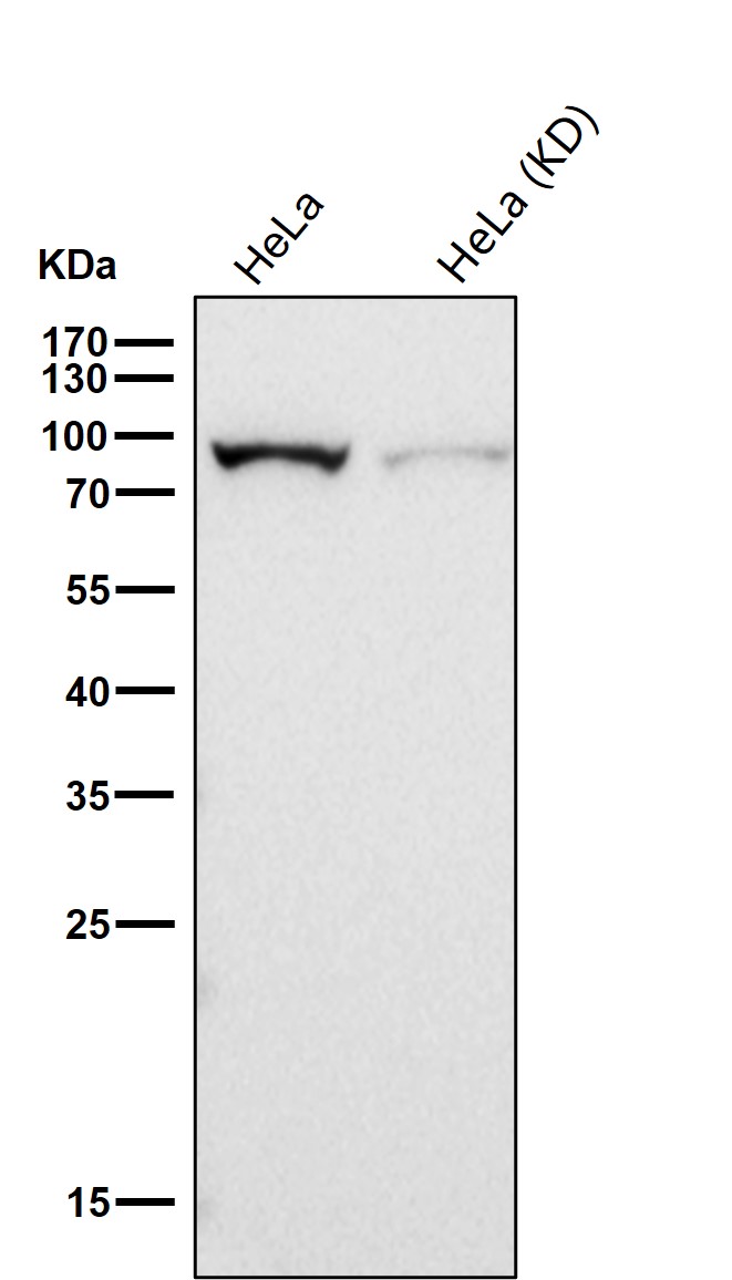 Insulin receptor Ab