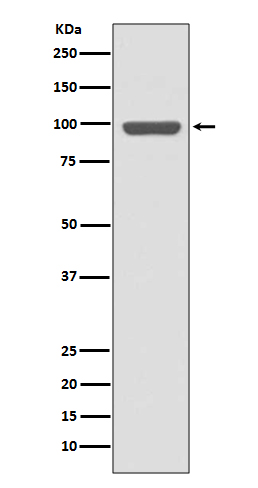 Insulin receptor Ab