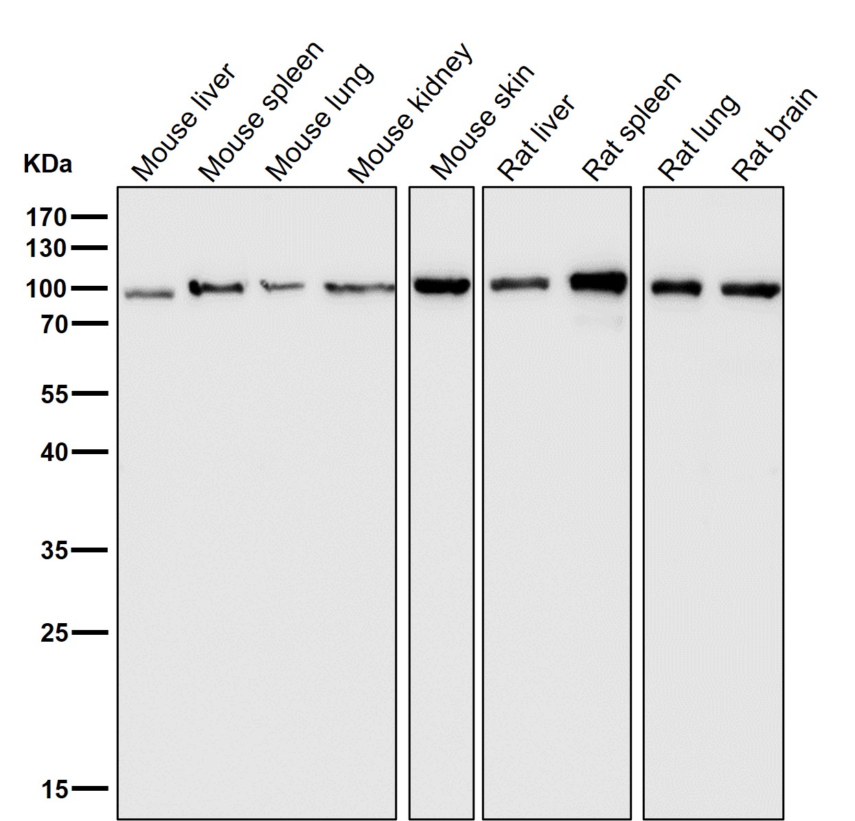 Insulin receptor Ab