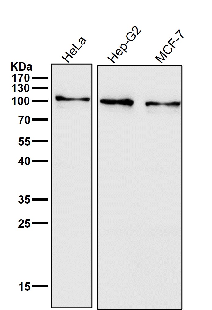 Insulin receptor Ab