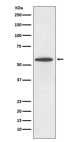 Interferon regulatory factor 5 Ab