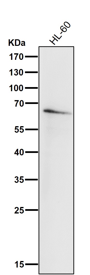 Interferon regulatory factor 5 Ab