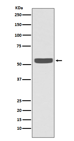 Cytokeratin 2e Ab