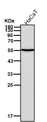 Cytokeratin 2e Ab