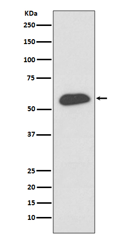 Interferon regulatory factor 5 Ab