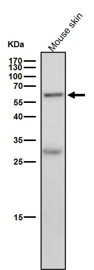 Interferon regulatory factor 5 Ab