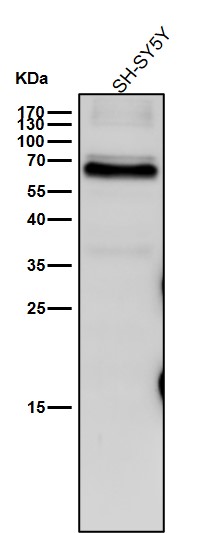 Interferon regulatory factor 5 Ab