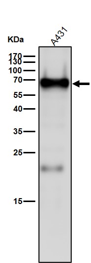 Interferon regulatory factor 5 Ab