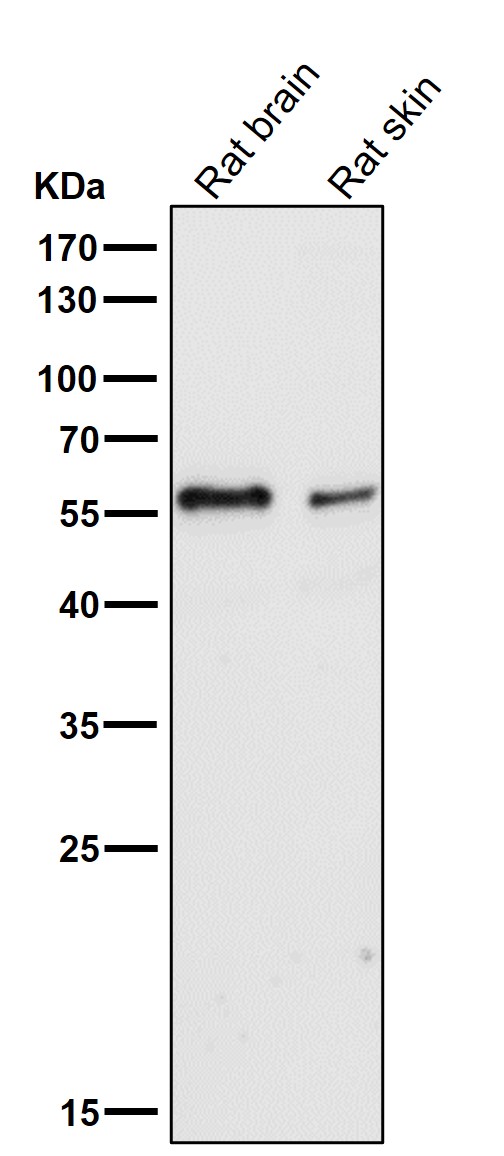 Interferon regulatory factor 5 Ab