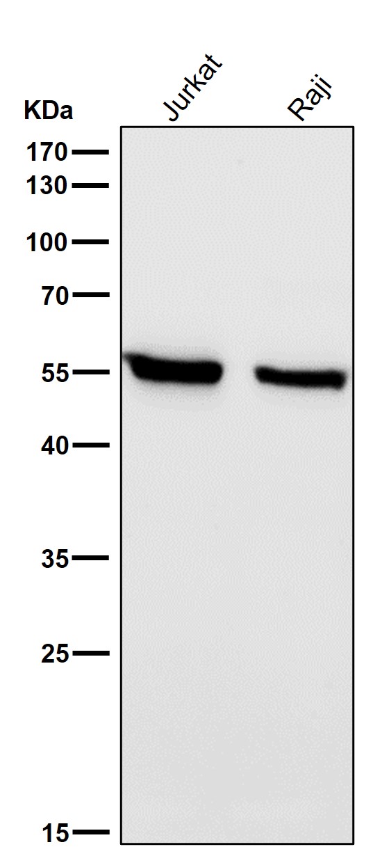 Interferon regulatory factor 5 Ab