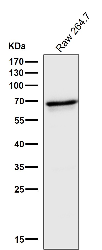 Interferon regulatory factor 5 Ab