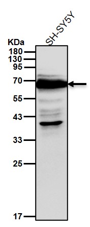 SOX11 Ab