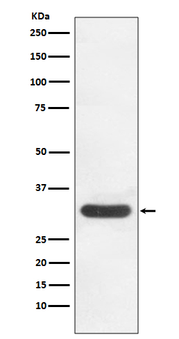 CDK4 Ab