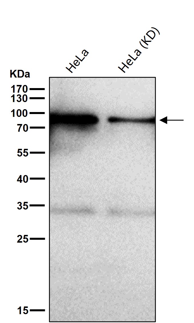 Calnexin Ab