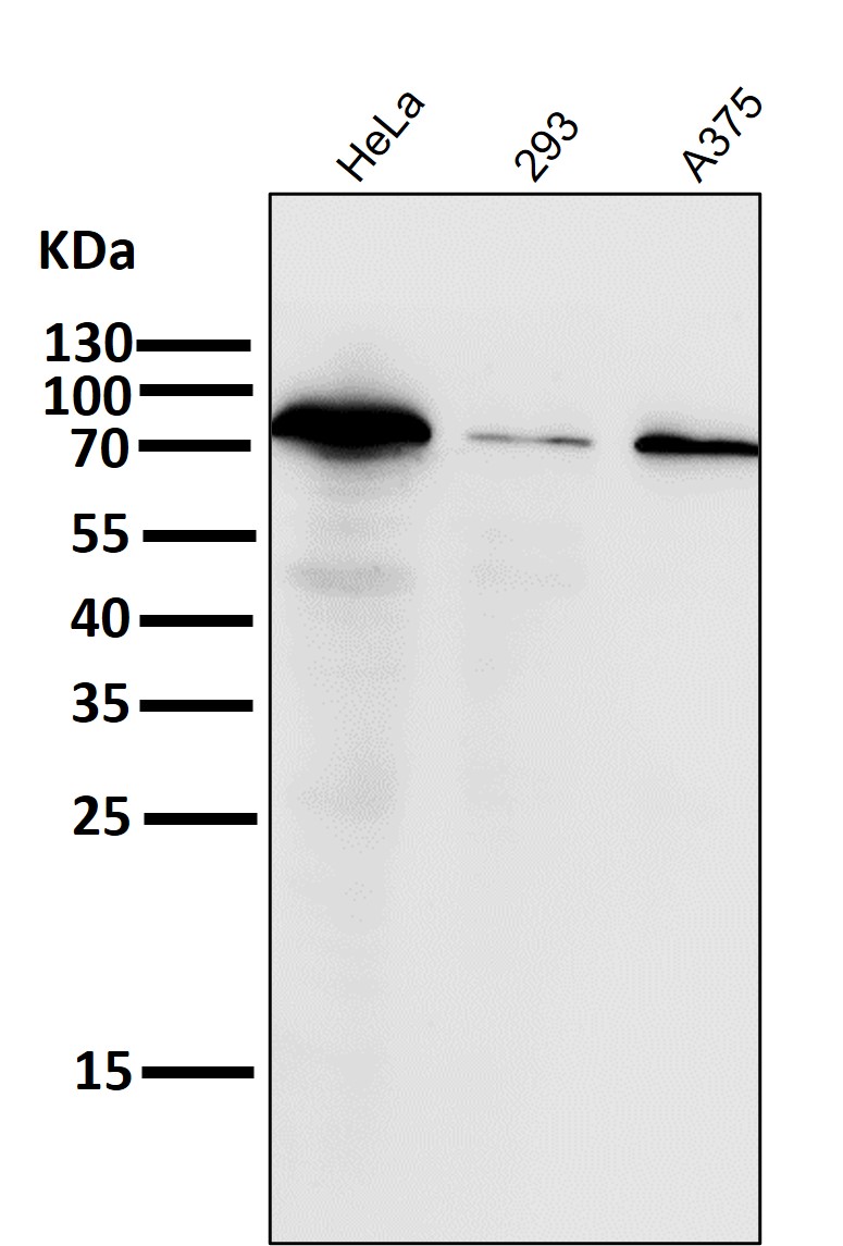 Calnexin Ab