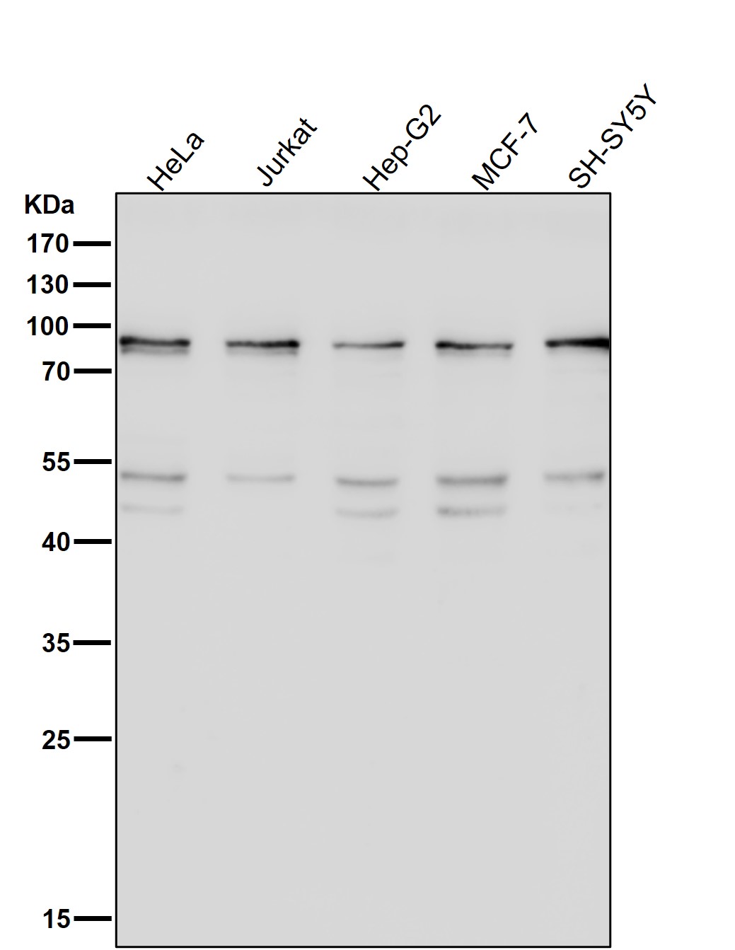 STAT1 Ab