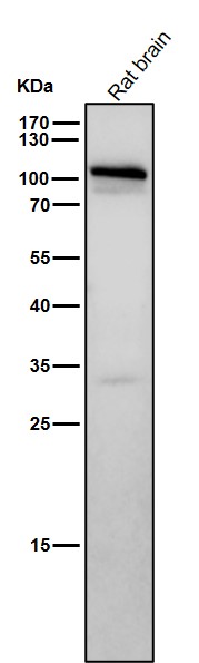 STAT2 Ab